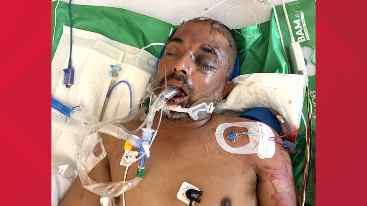 University Hospital asks for help identifying unconscious patient hit by truck Saturday evening — KENS 5 (San Antonio), Ross Health news