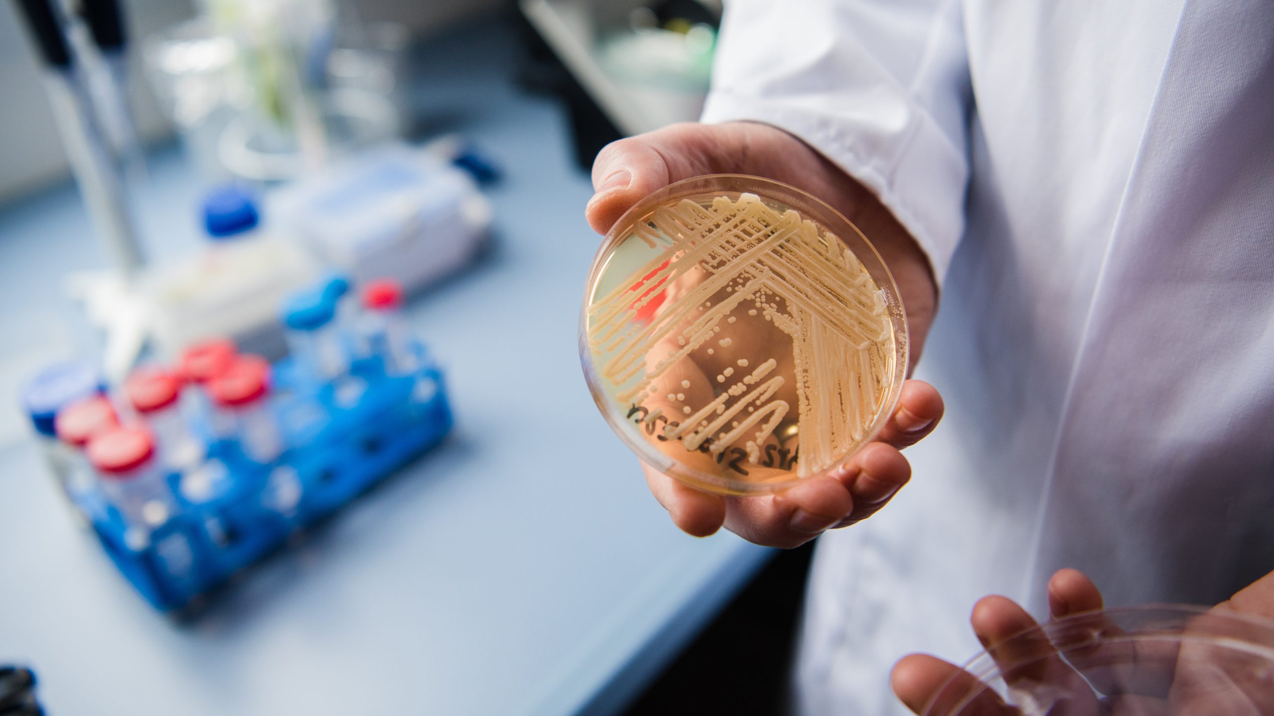 New study reveals why dangerous fungus is so difficult to treat — KTVU FOX 2 Bay Area, Ross Community news
